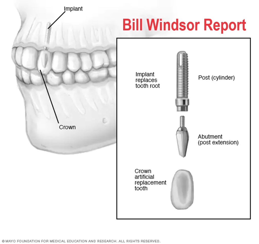 Bill Windsor Oral Surgery